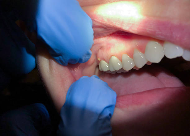 Best Cracked Tooth Emergency Dentist  in Refugio, TX