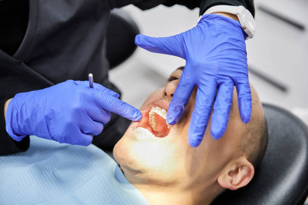 Best Chipped Tooth Repair Near Me  in Refugio, TX